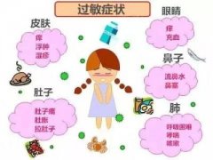 [阳泉过敏医院]花粉过敏的预防措施